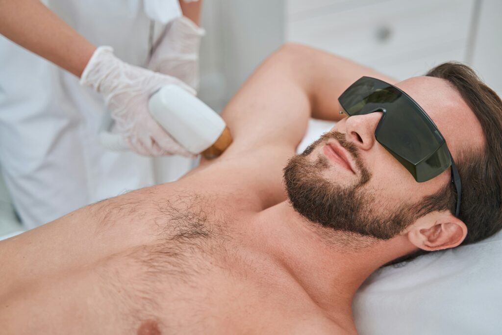 homme-epilation-laser