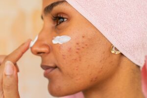 dentifrice-pour-les-boutons