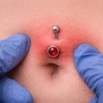 piercing-infecte-nombril